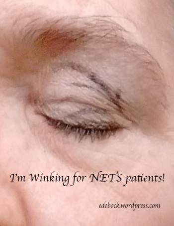 IMG_20170615_104430200 2